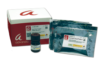 Electrophoresis